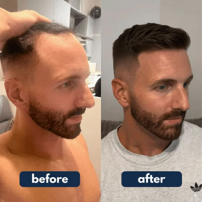 STRANDUP - Hair Growth Serum