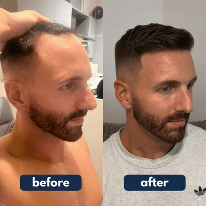 Hair Growth Serum